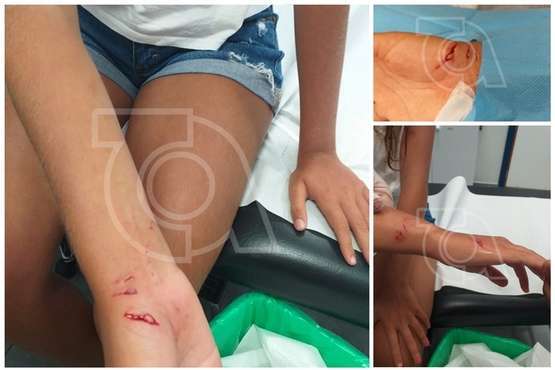 Una menor sufre la dentellada de un pez mientras se bañaba en Melenara (Foto TA)